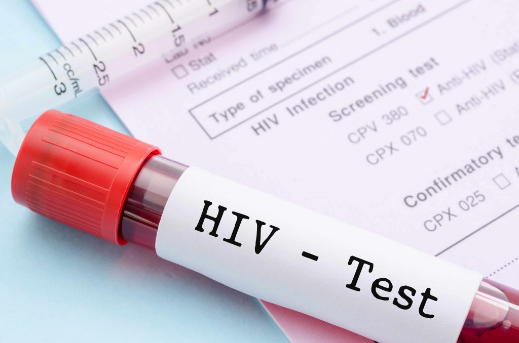 When is it recommended to get an HIV test?